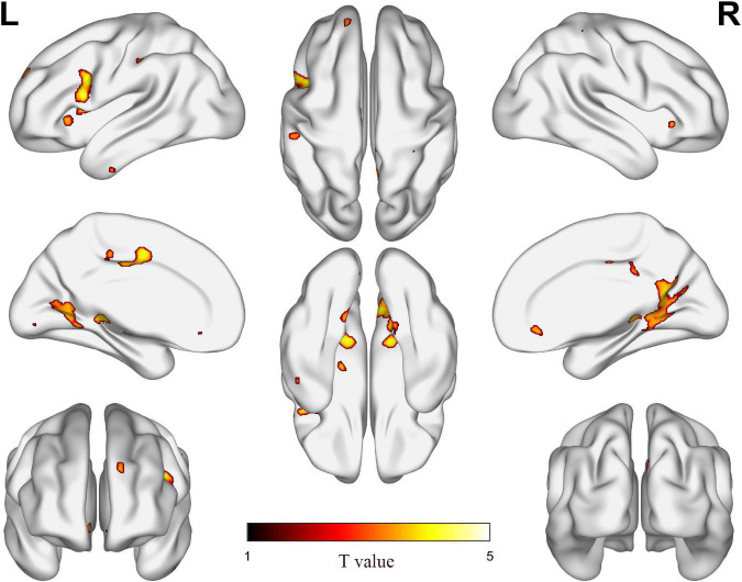 FIGURE 1