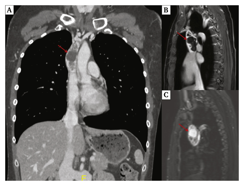 Figure 1