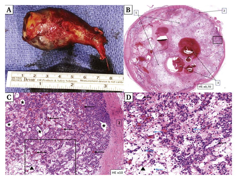 Figure 3