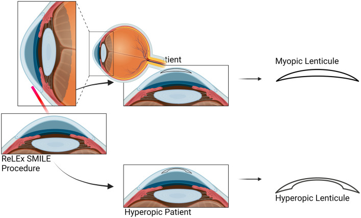 Fig. 3