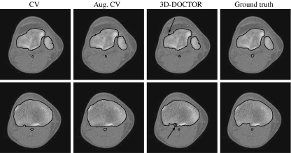 Fig 11