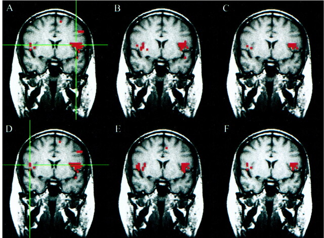 fig 3.