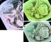 Fig. 1