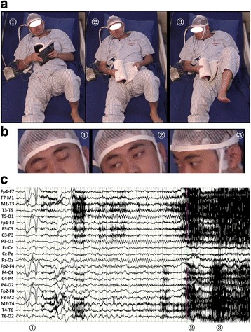 Fig. 1