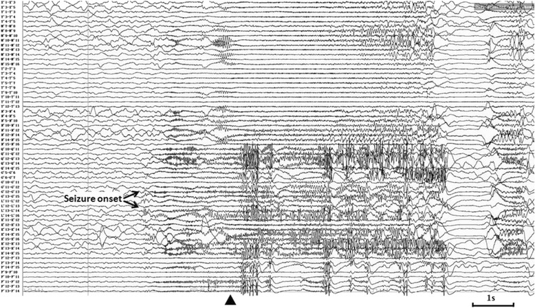 Fig. 5