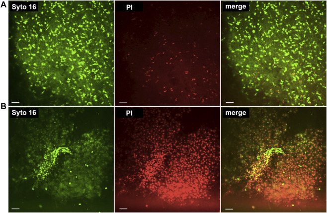 FIGURE 3