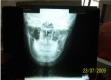 Fig. 4: