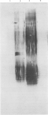 45