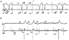 Fig. (16)