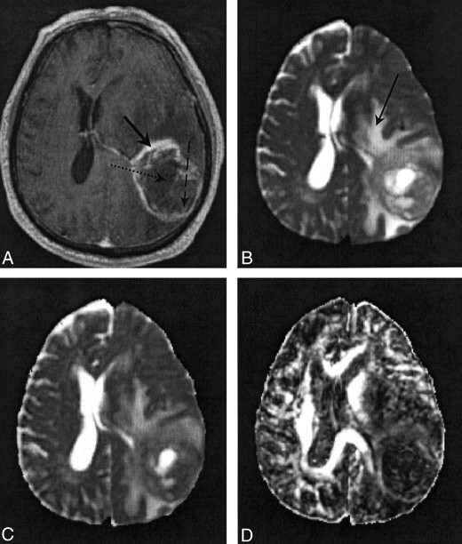 Fig 2.