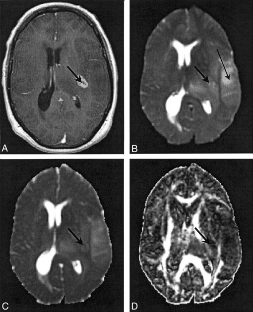 Fig 3.