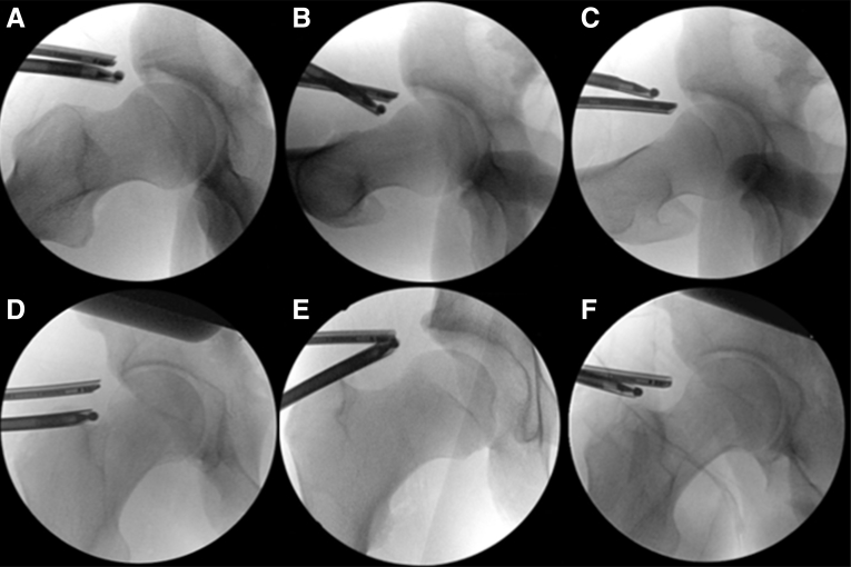 Fig 2