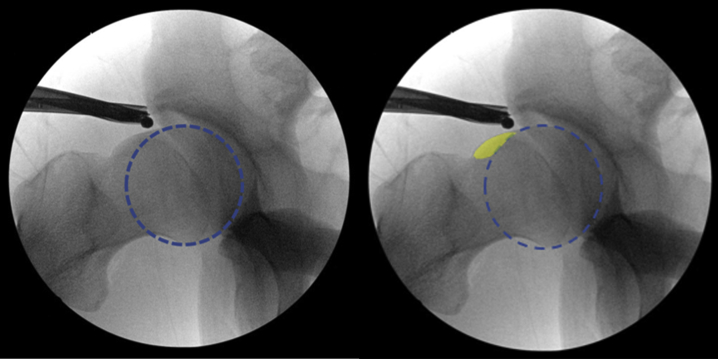 Fig 4