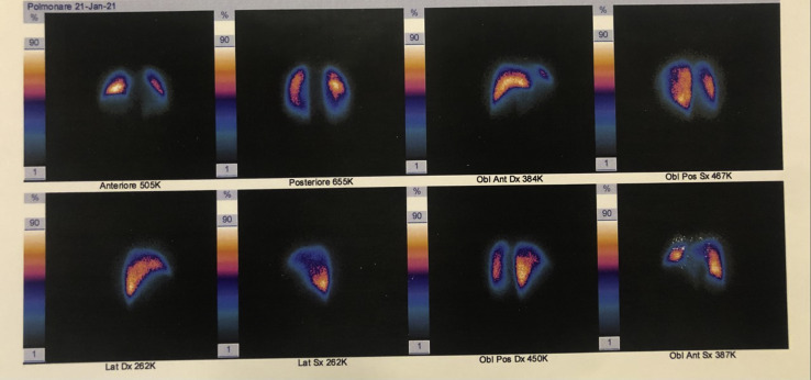 Fig. 2