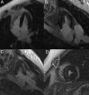 Fig. 27