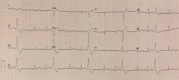 Fig. 25
