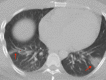 Fig. 20