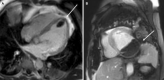 Fig. 33