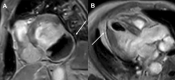 Fig. 35