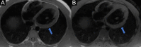 Fig. 12