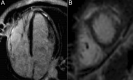 Fig. 13