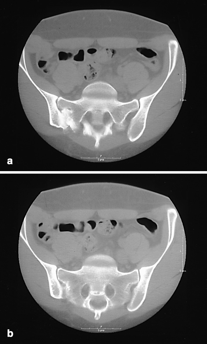 Fig. 3a, b