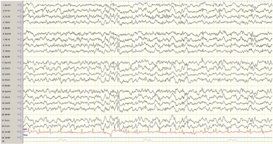 Fig. 3