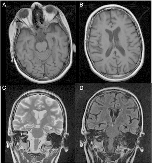 Fig. 1