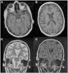 Fig. 1
