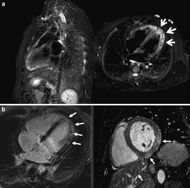 Fig. 9