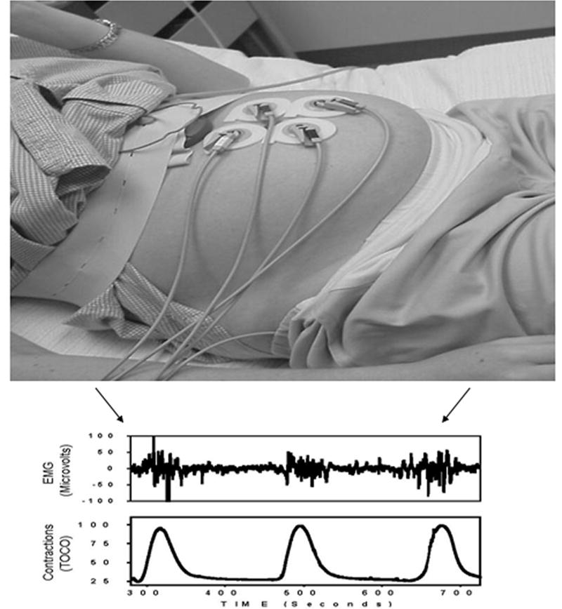 Fig 3