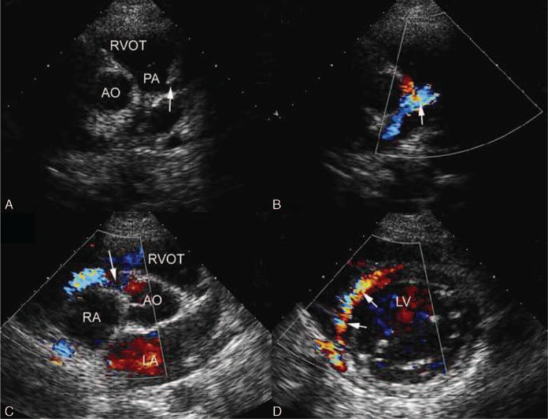 FIGURE 4