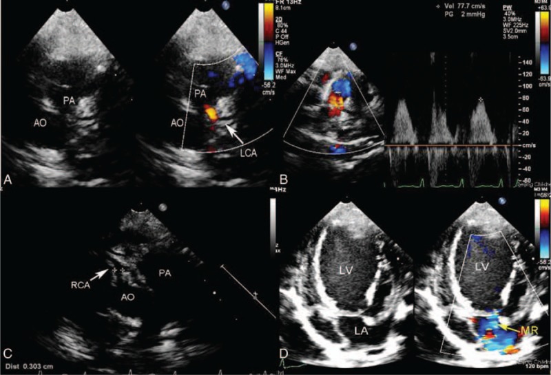 FIGURE 2