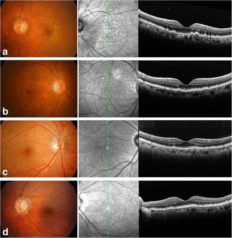 Fig. 1