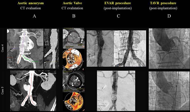 Fig. 4