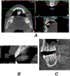 Fig. 4