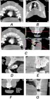 Fig. 6