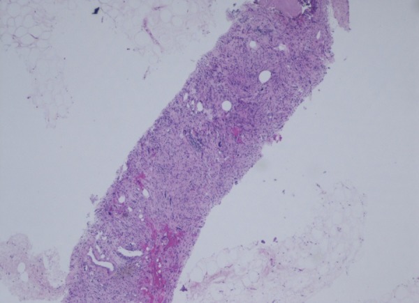 Figure 4: