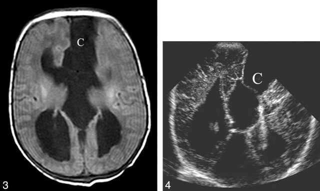 Fig 3.