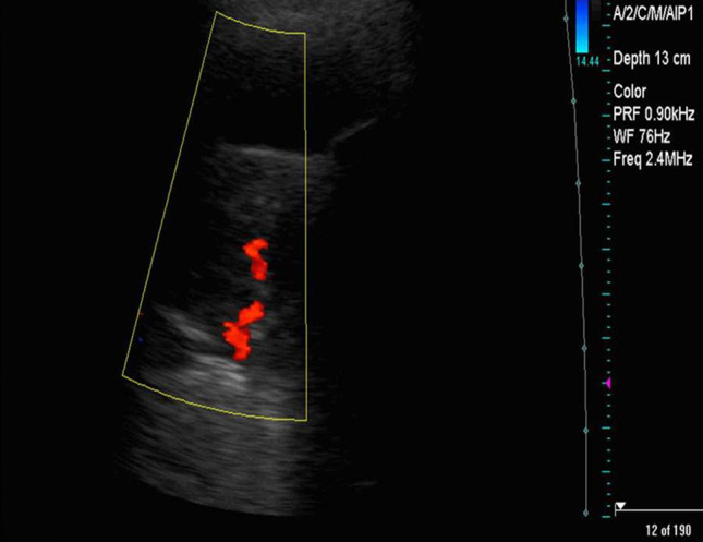 Fig. 4