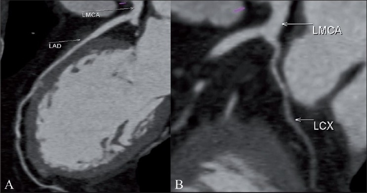 Figure 2 (A,B)