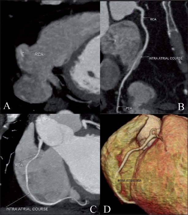 Figure 1 (A-D)