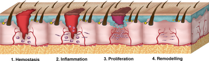 FIGURE 2