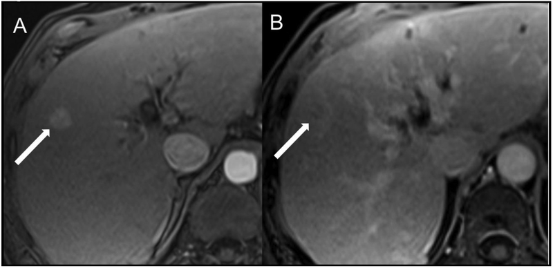 Fig 5.