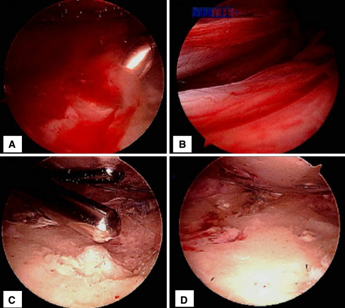 Fig. 1A–D