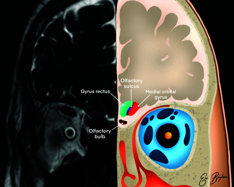 FIG 2.