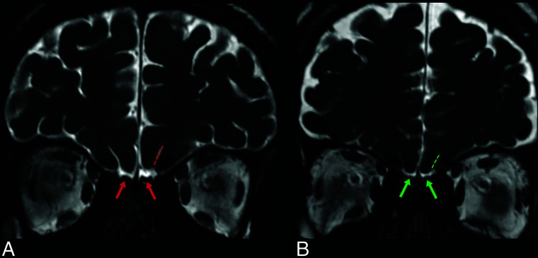 FIG 9.