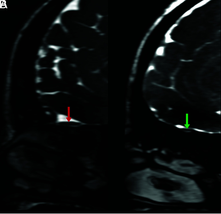 FIG 10.