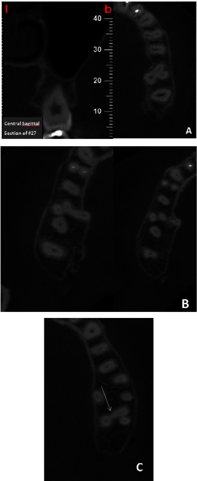 Fig. (3)