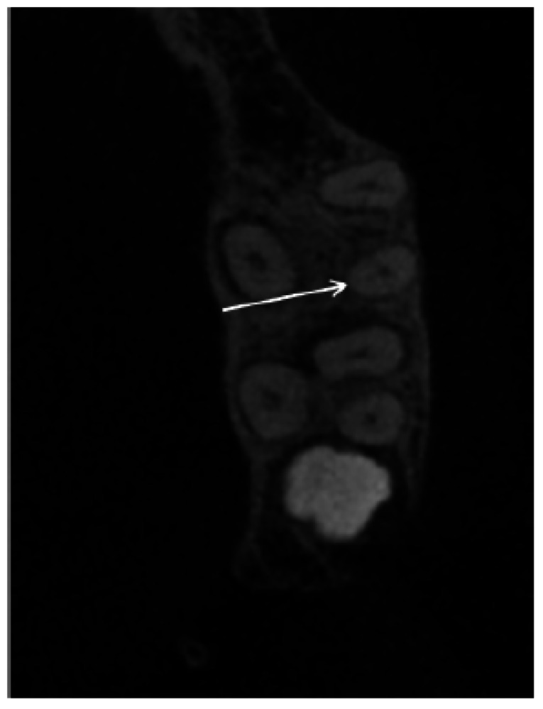 Fig. (2)